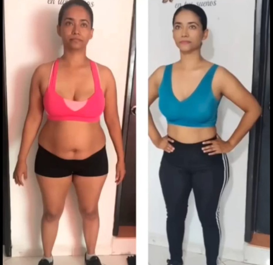 Comparativa antes y después vista frontal